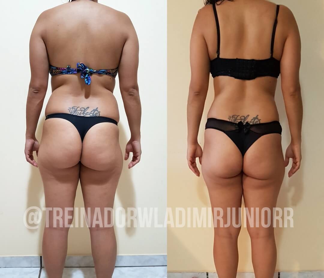 Antes e Depois